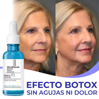 Serum Anti-Edad Efecto Botox – Nobelle Express